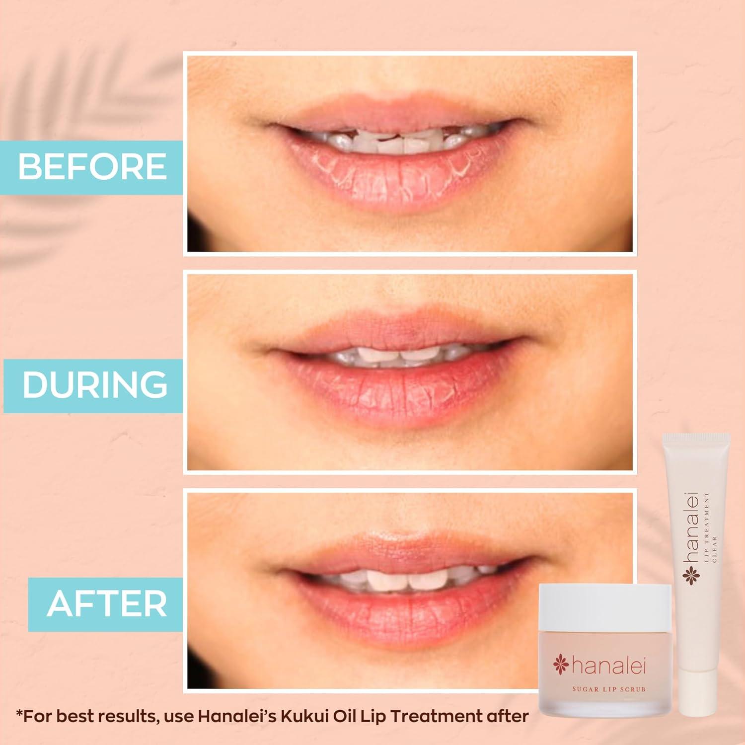 Exfoliante de Labios Vegano Hanalei - Azúcar de Caña Hawaiano 22g