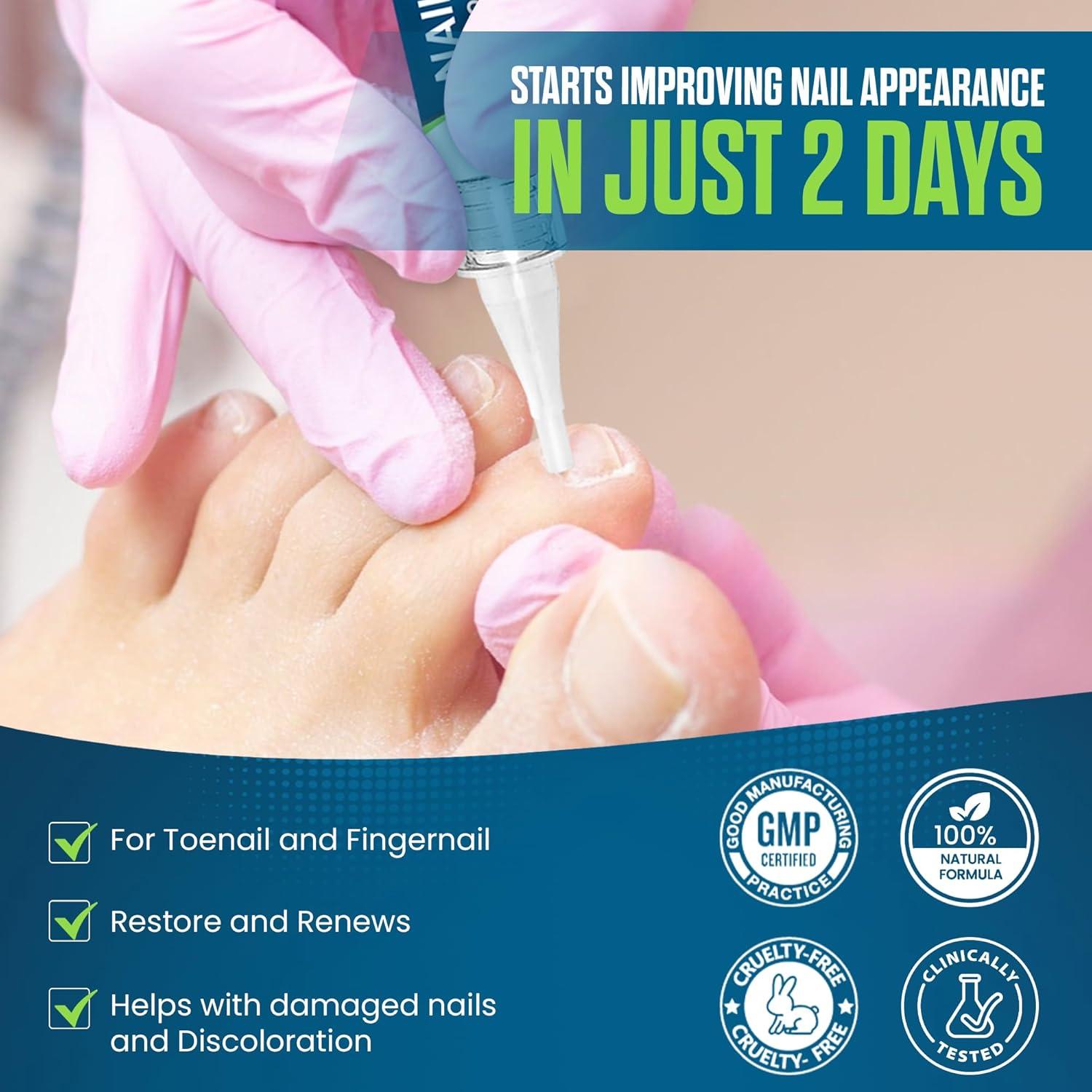 Bolígrafo Antifúngico FOOT CURE 2-Pack 25% Ácido Undecilénico