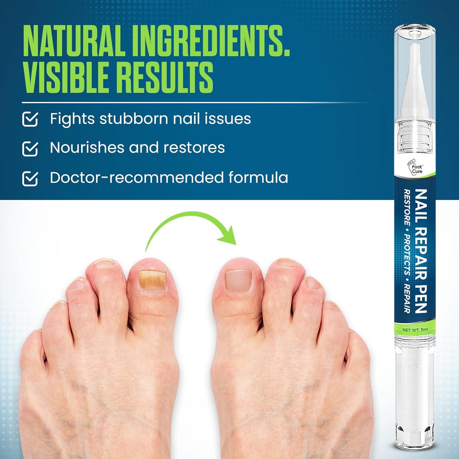 Bolígrafo Antifúngico FOOT CURE 2-Pack 25% Ácido Undecilénico