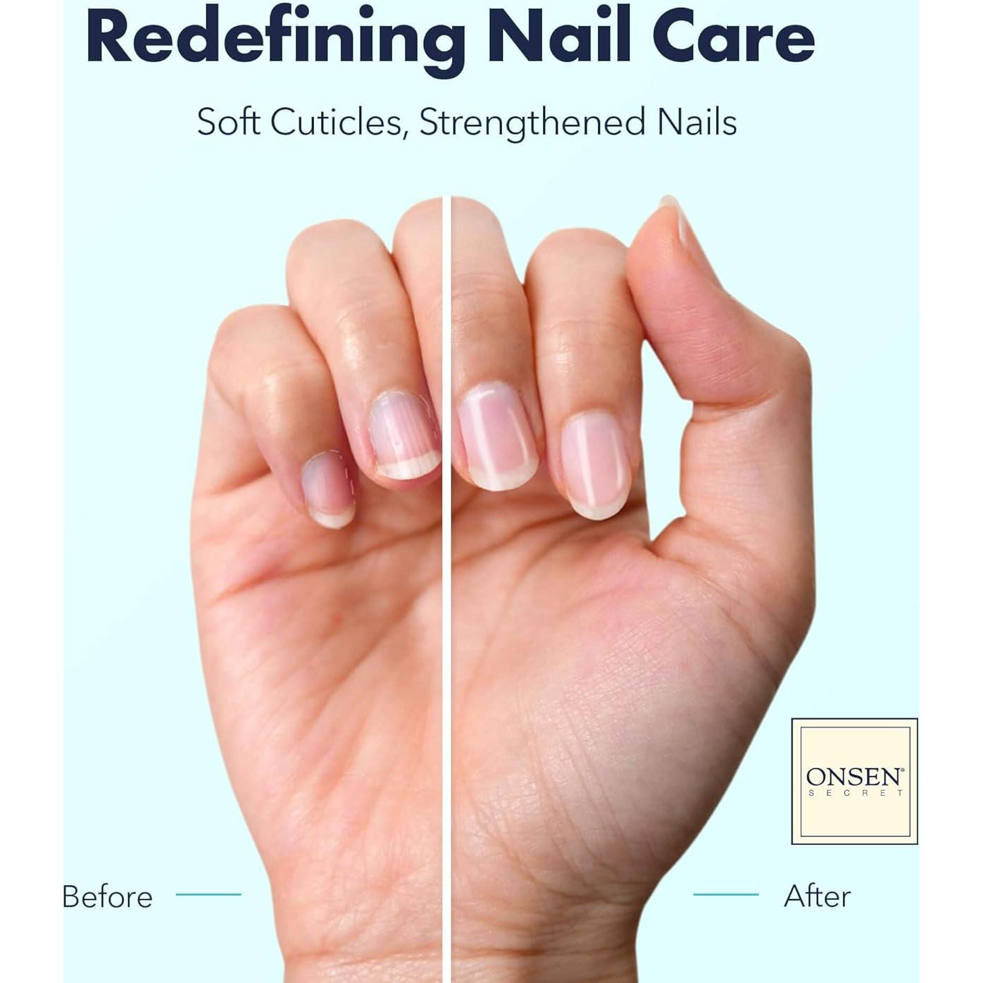 Aceite Reparador de Uñas Onsen Secret 30ml - Hidratante Natural