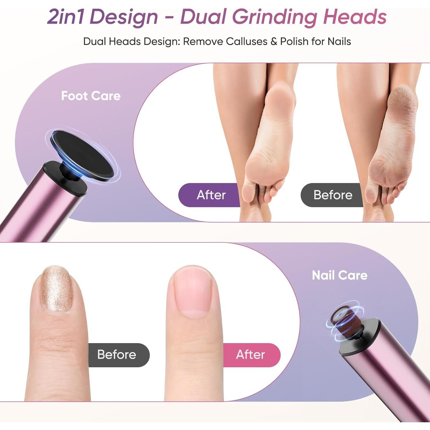 Removedor de Callos Eléctrico 2 en 1 Lima Recargable FR10