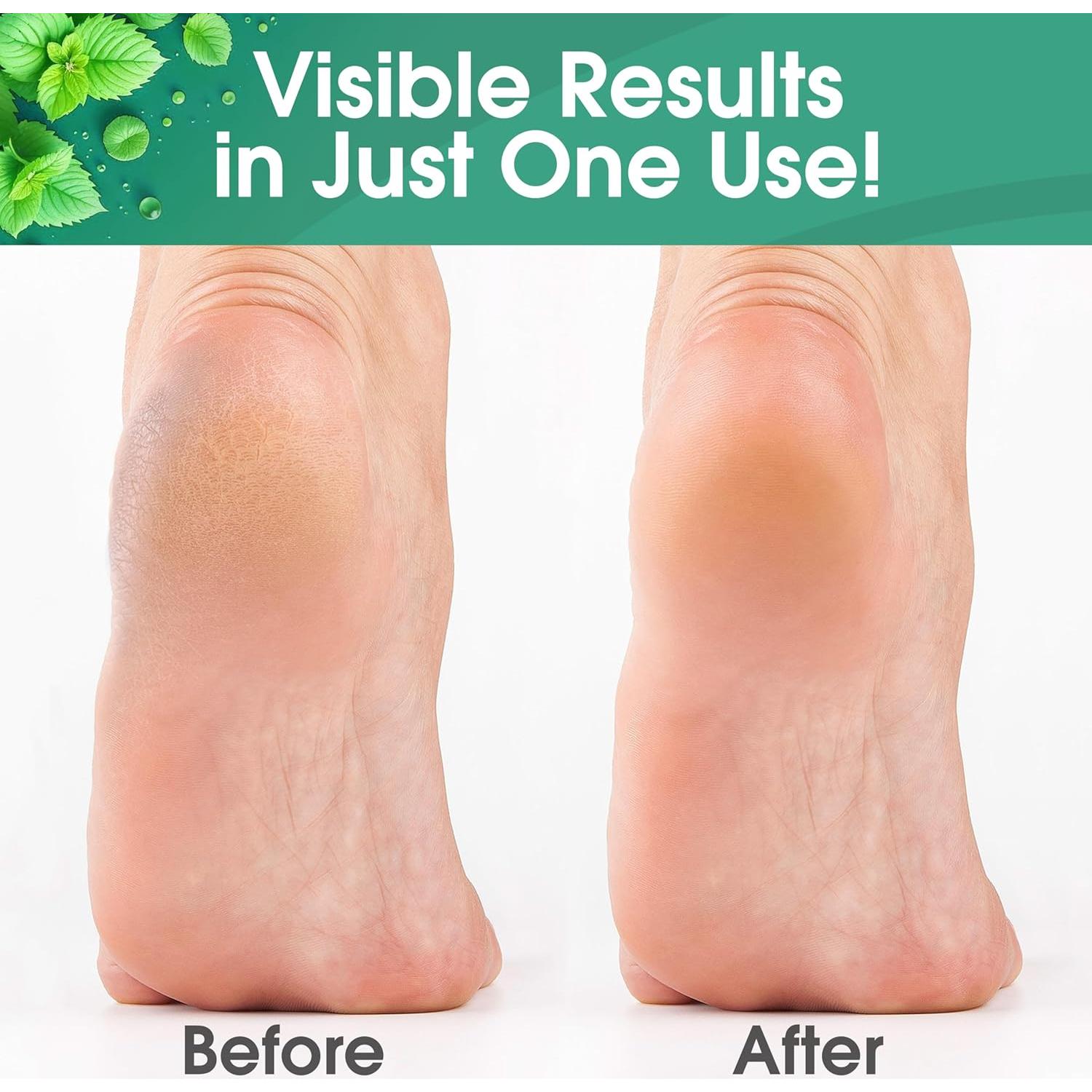 Gel Removedor de Callos DeEnti 236ml Fuerza Extra Menta