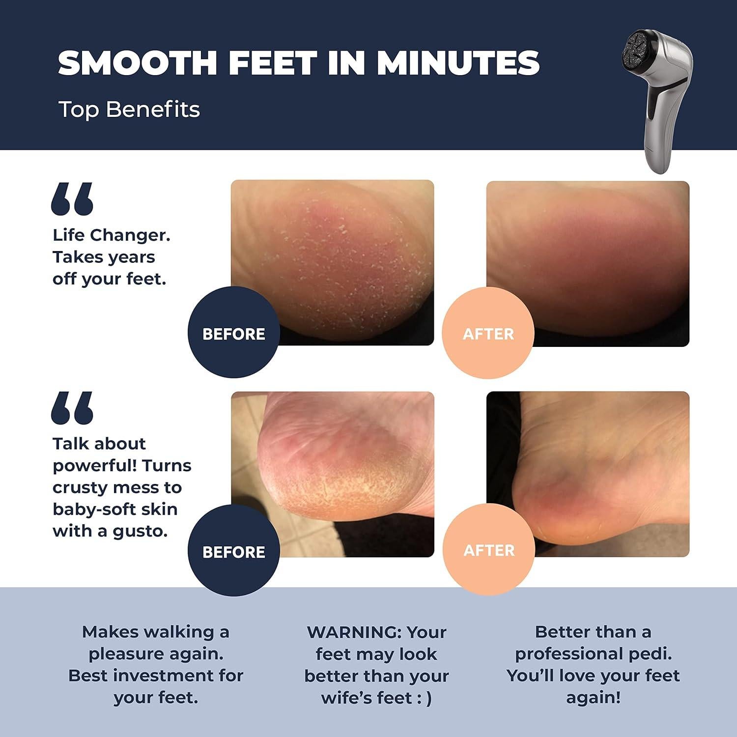 Removedor de Callos Eléctrico Own Harmony CR2100 - 3 Rodillos