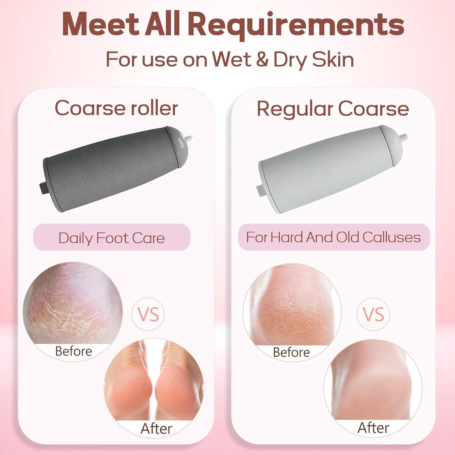 Removedor de Callos Eléctrico XinJuQuan - Pedicura Portátil 2 Velocidades