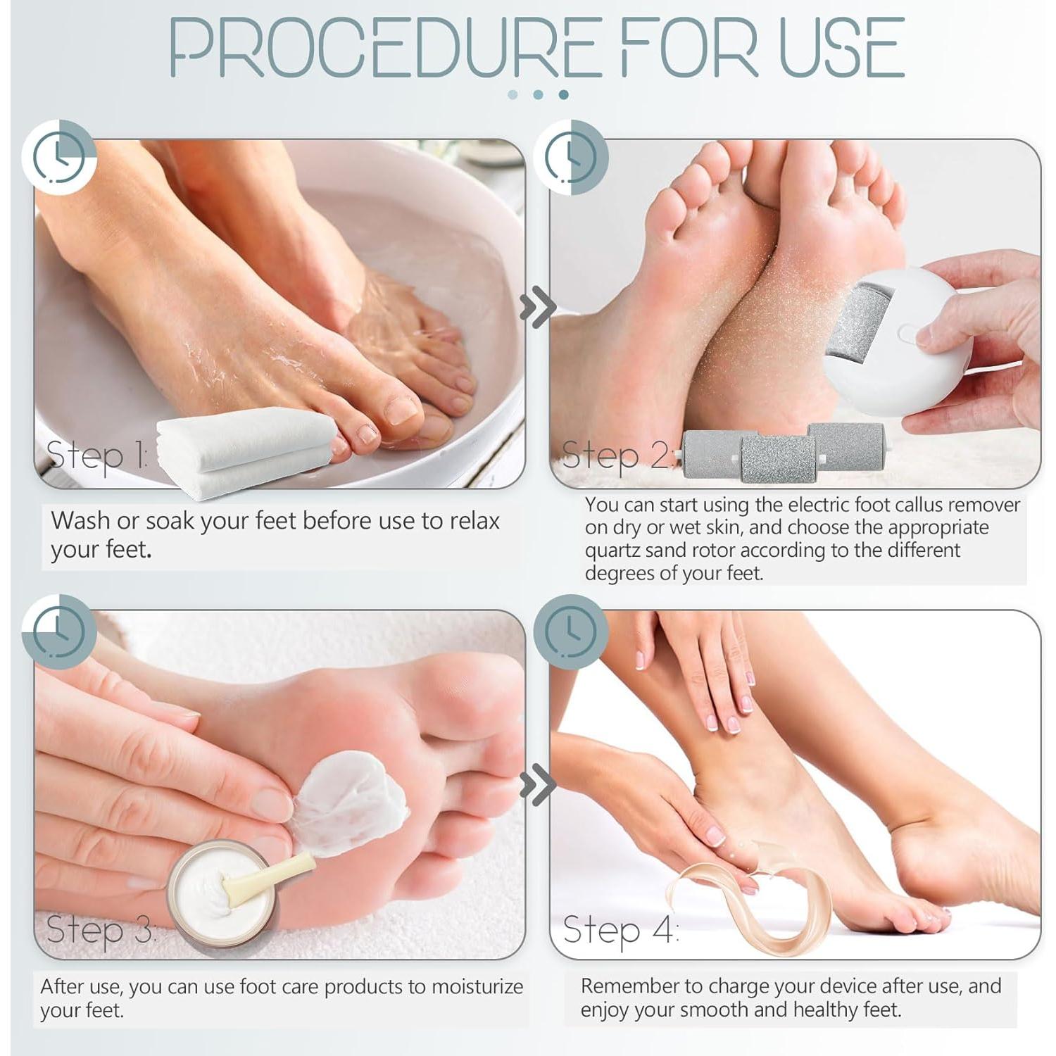 Removedor de Callos Eléctrico Pararose MJQ-009 Recargable