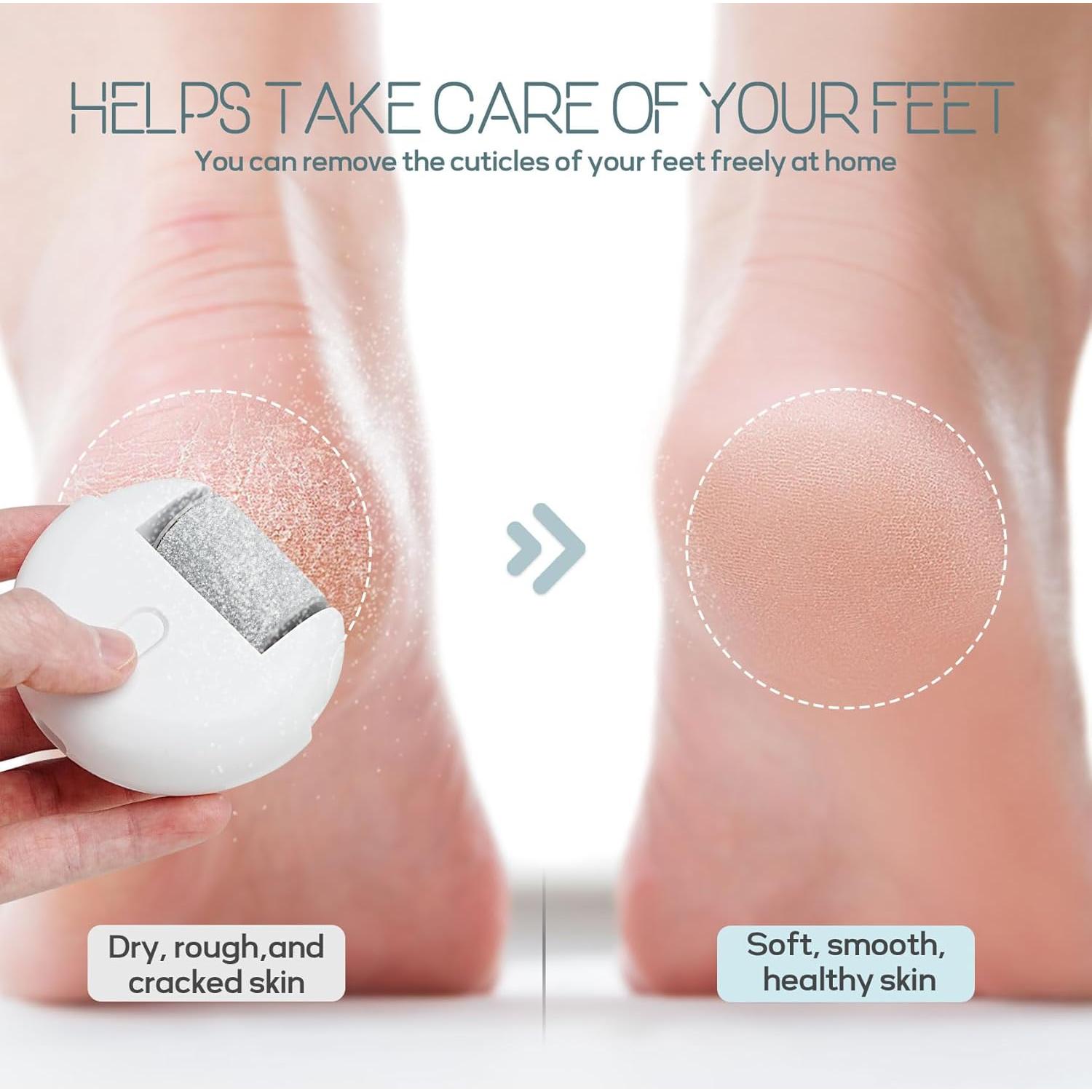 Removedor de Callos Eléctrico Pararose MJQ-009 Recargable