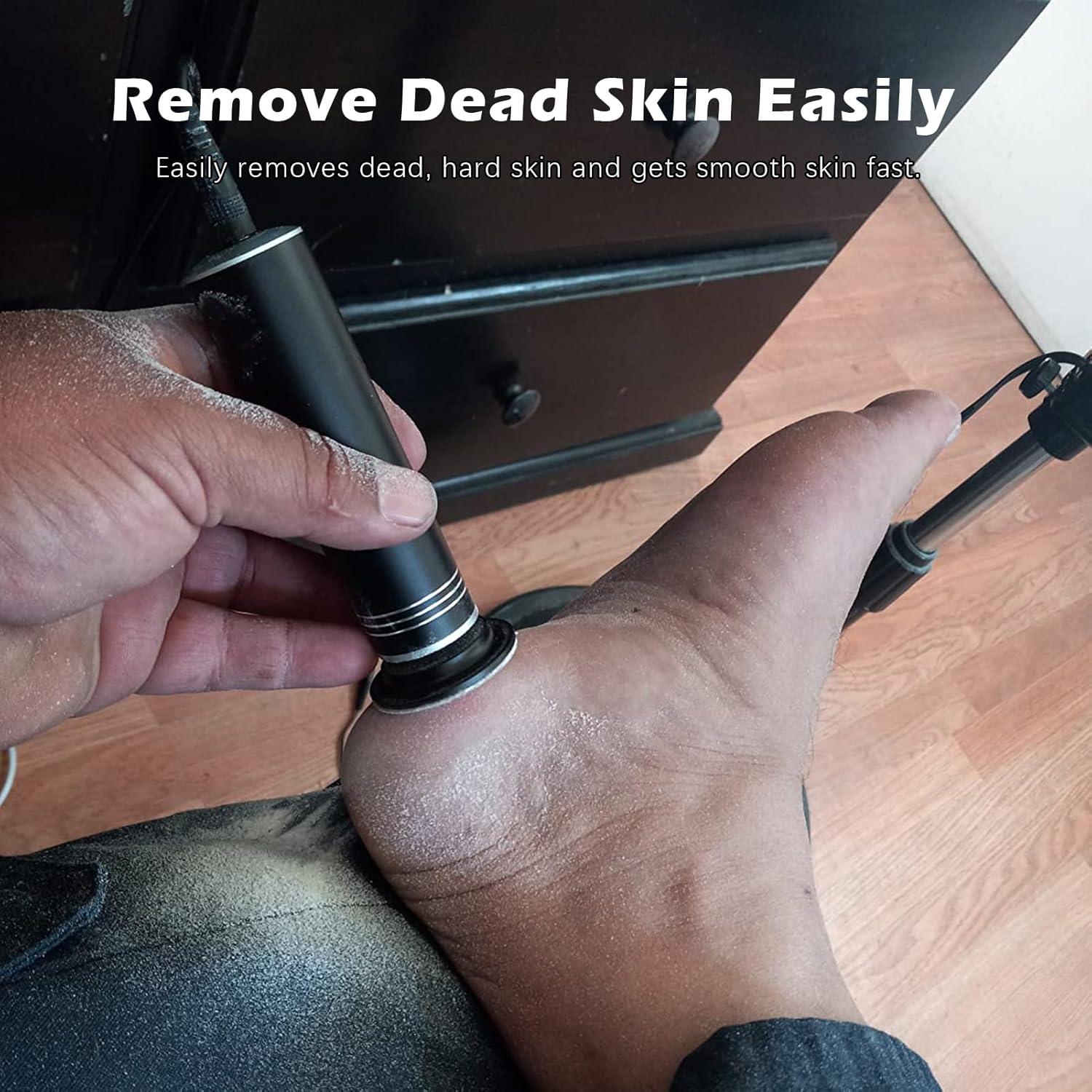 Removedor de Callos Eléctrico I.B.N FCR-2 1200RPM Ajustable