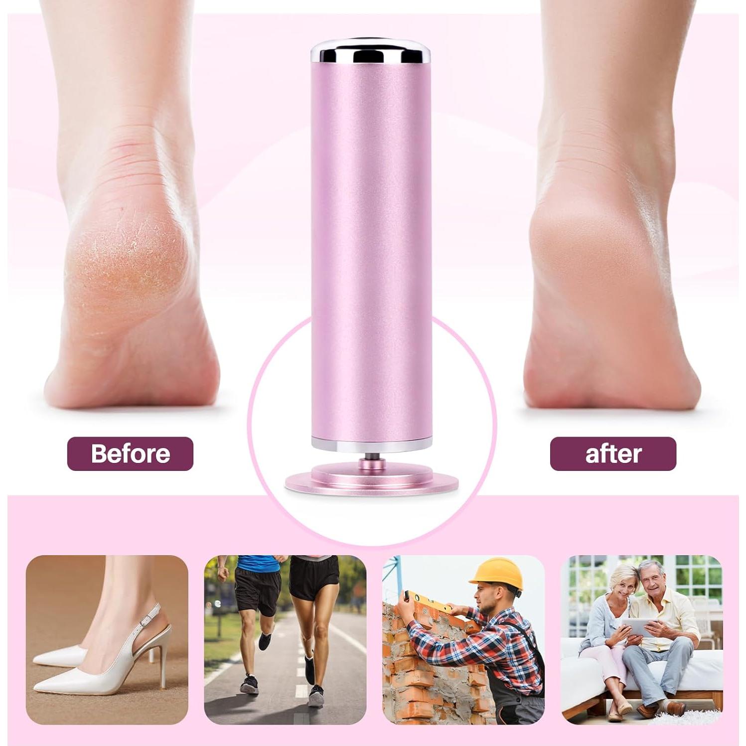 Removedor de Callos Eléctrico LIONVISON con 60 Discos de Lija