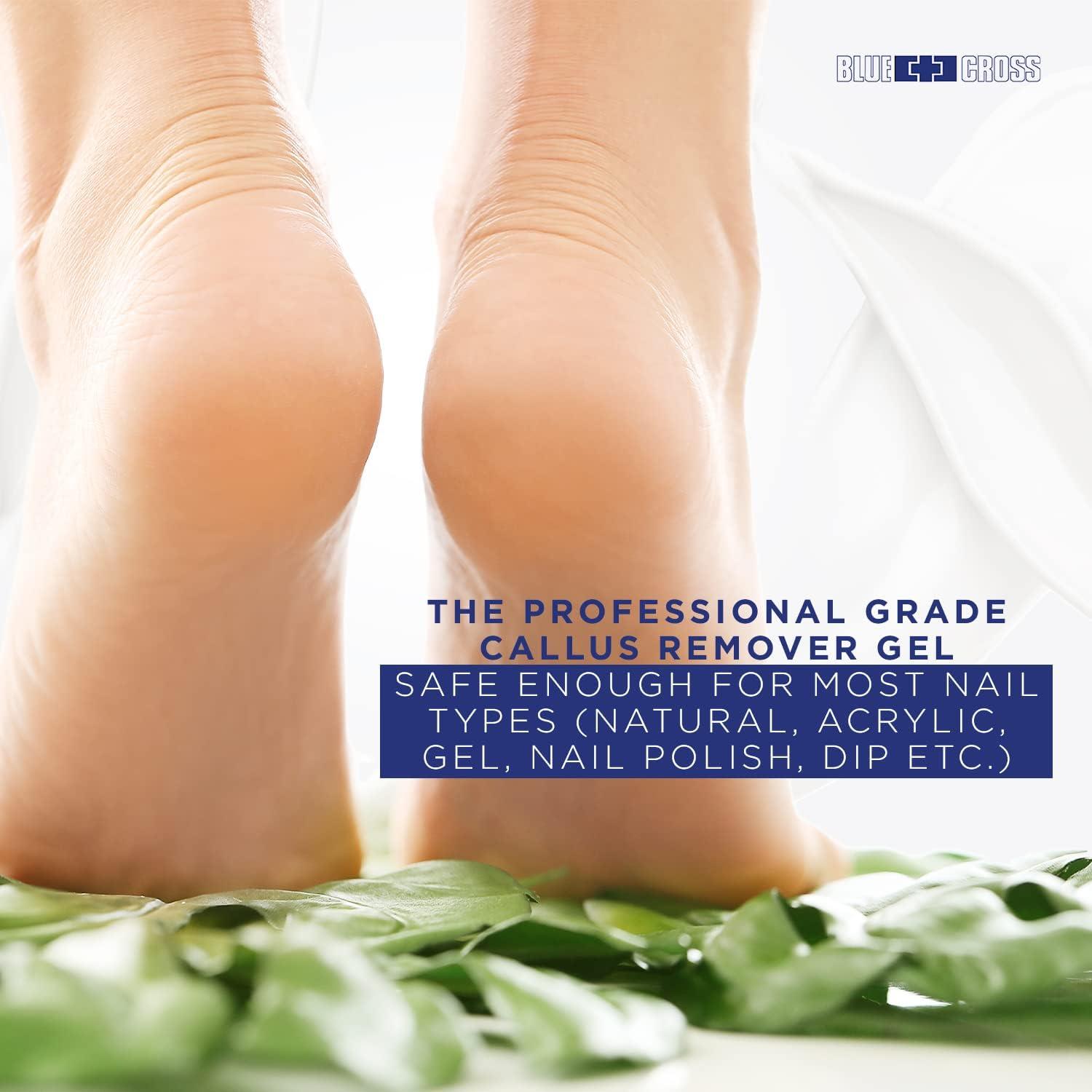 Gel Removedor de Callos Blue Cross 946ml - Fuerza Extra Profesional