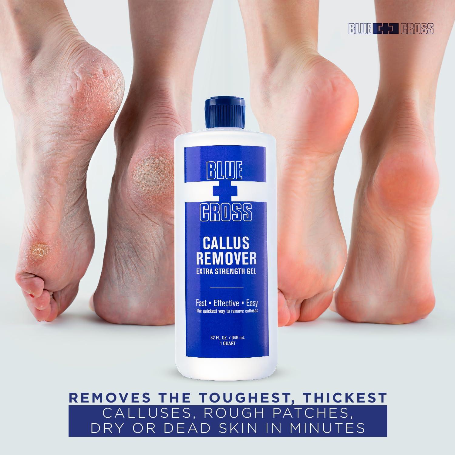 Gel Removedor de Callos Blue Cross 946ml - Fuerza Extra Profesional