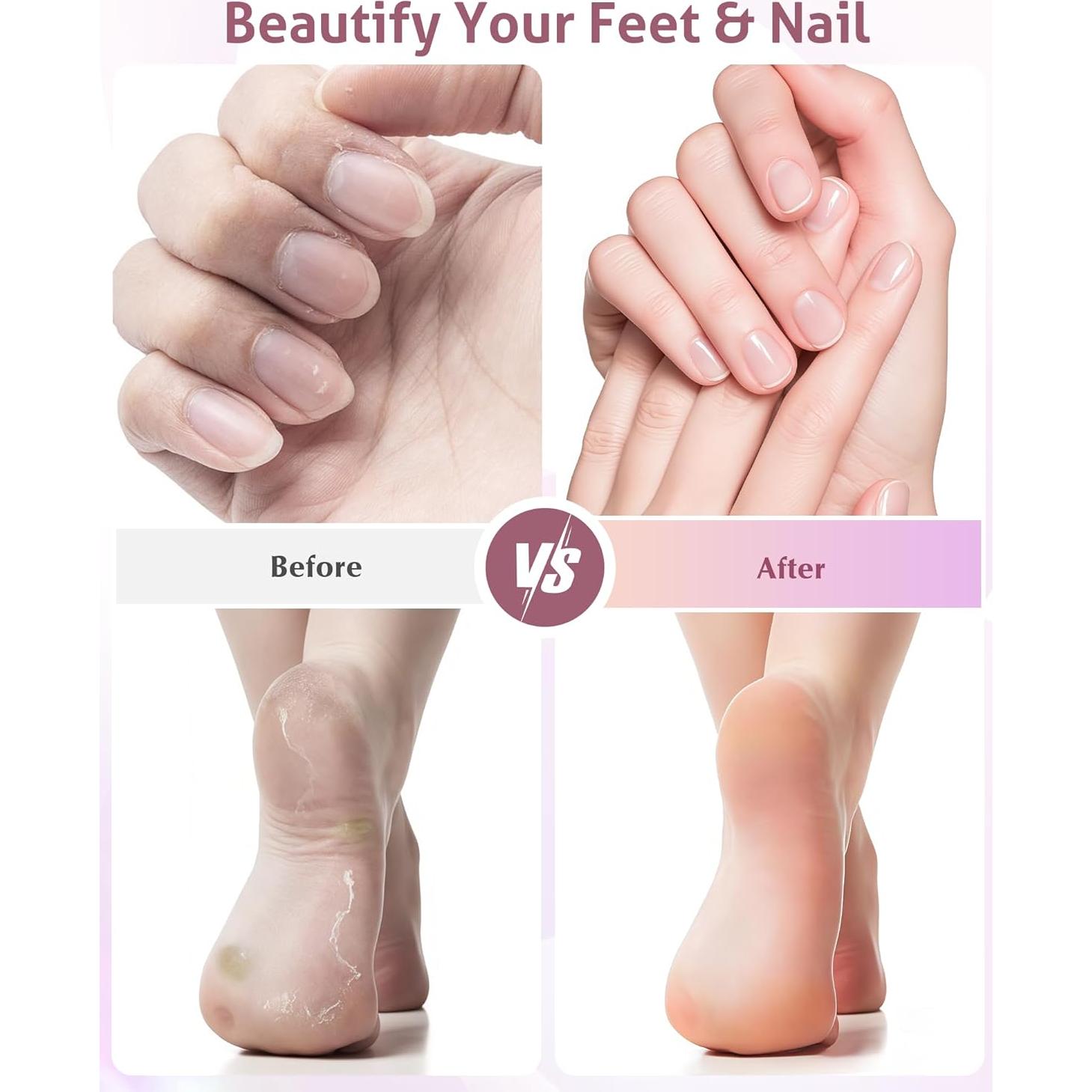 Removedor de Callos Eléctrico COOAOO 9 Velocidades USB