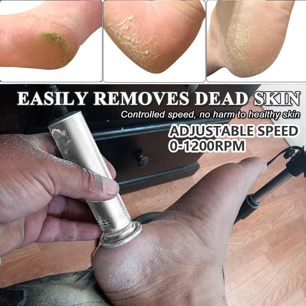 Removedor de Callos Eléctrico I·B·N G, 1200 RPM, Plata