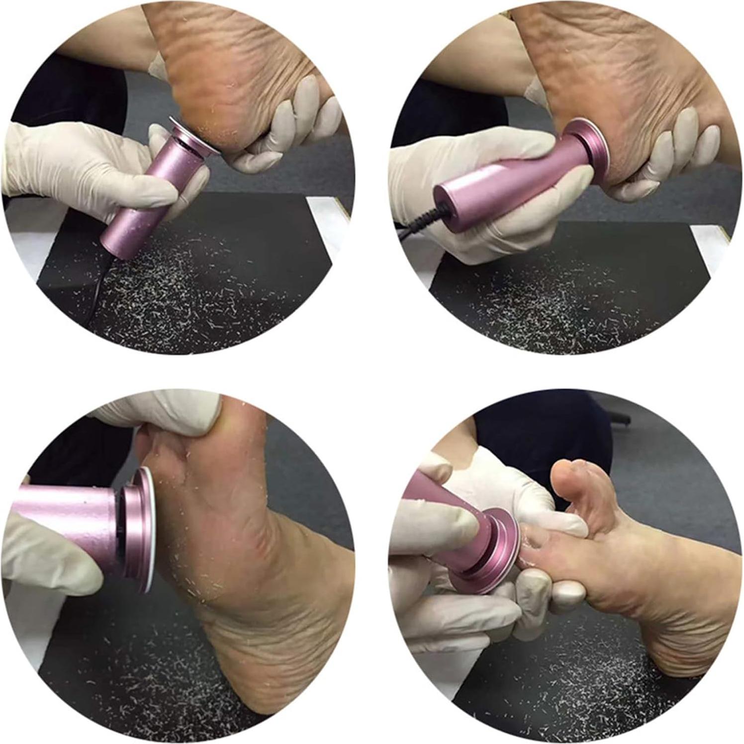 Removedor de Callos Eléctrico Ravifun con 60 Discos de Lija