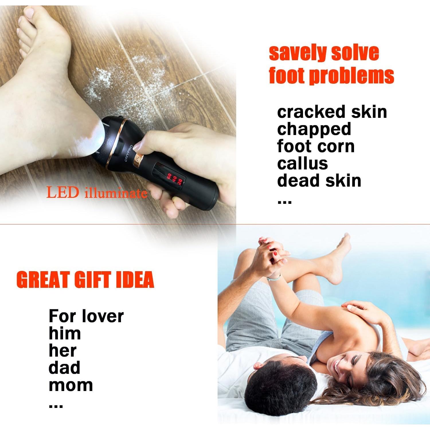 Removedor de Callos Eléctrico CIVYPRO BK-506 Recargable Negro