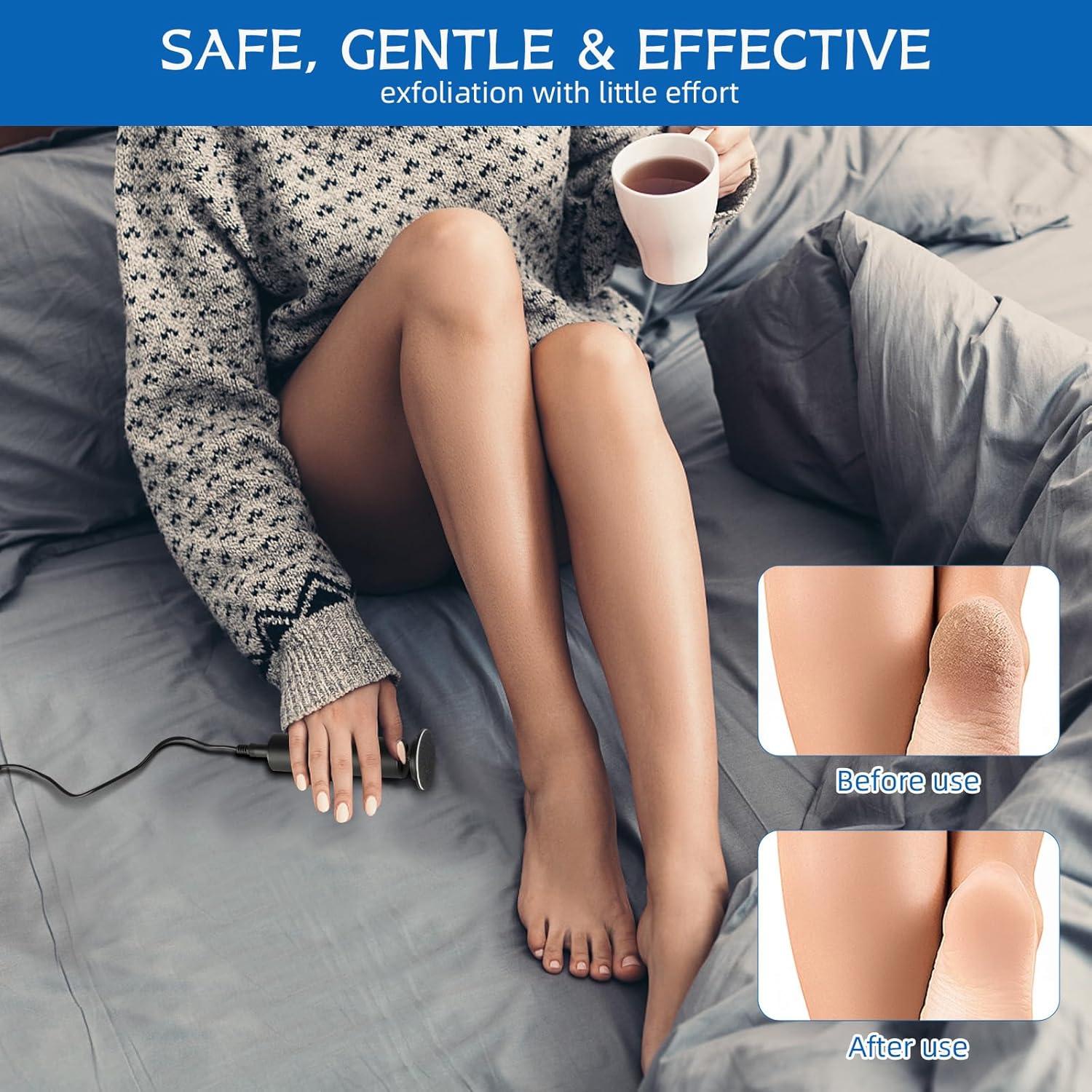 Removedor de Callos Eléctrico Dermave Negro con 60 Discos