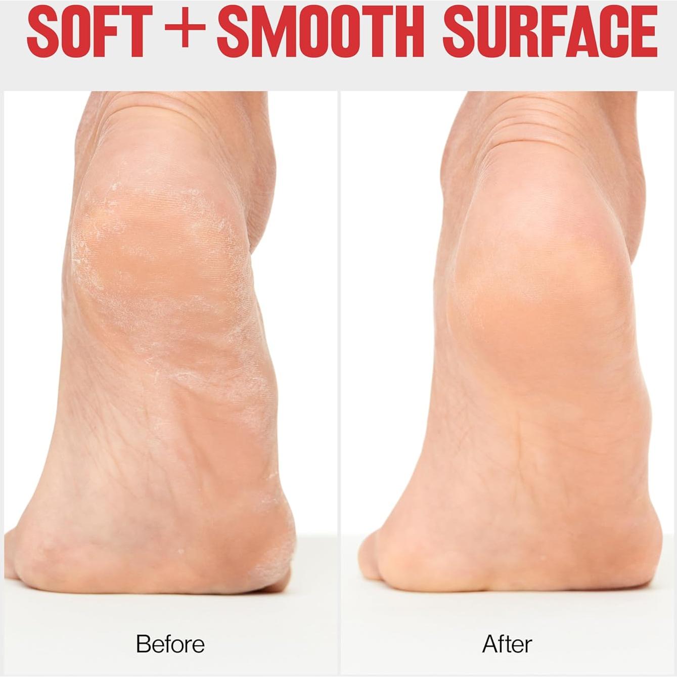 Lima para Pies Revlon Removedor de Callos Húmeda/Seca 25cm