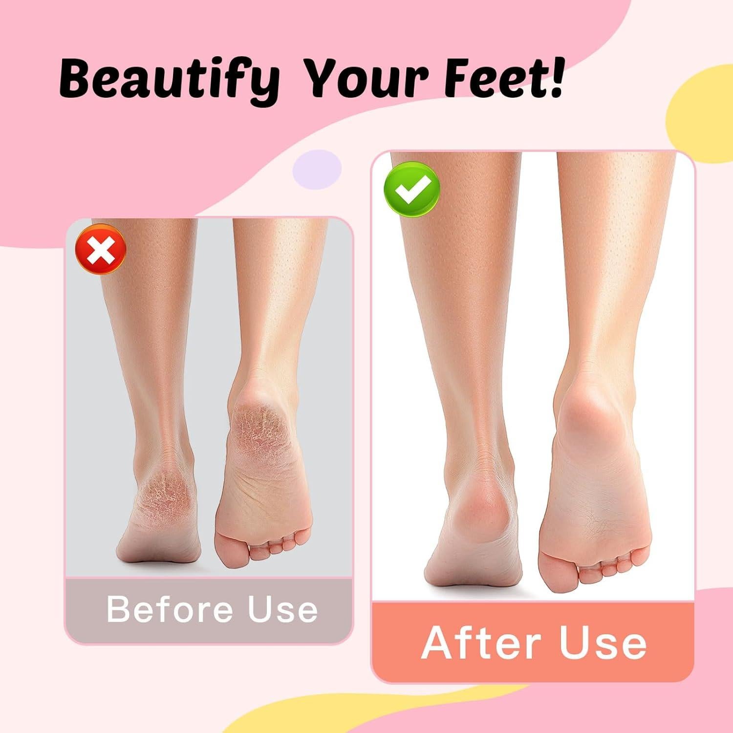 Removedor de Callos Eléctrico Dongguan FR10, 9 Velocidades, Carga Tipo-C