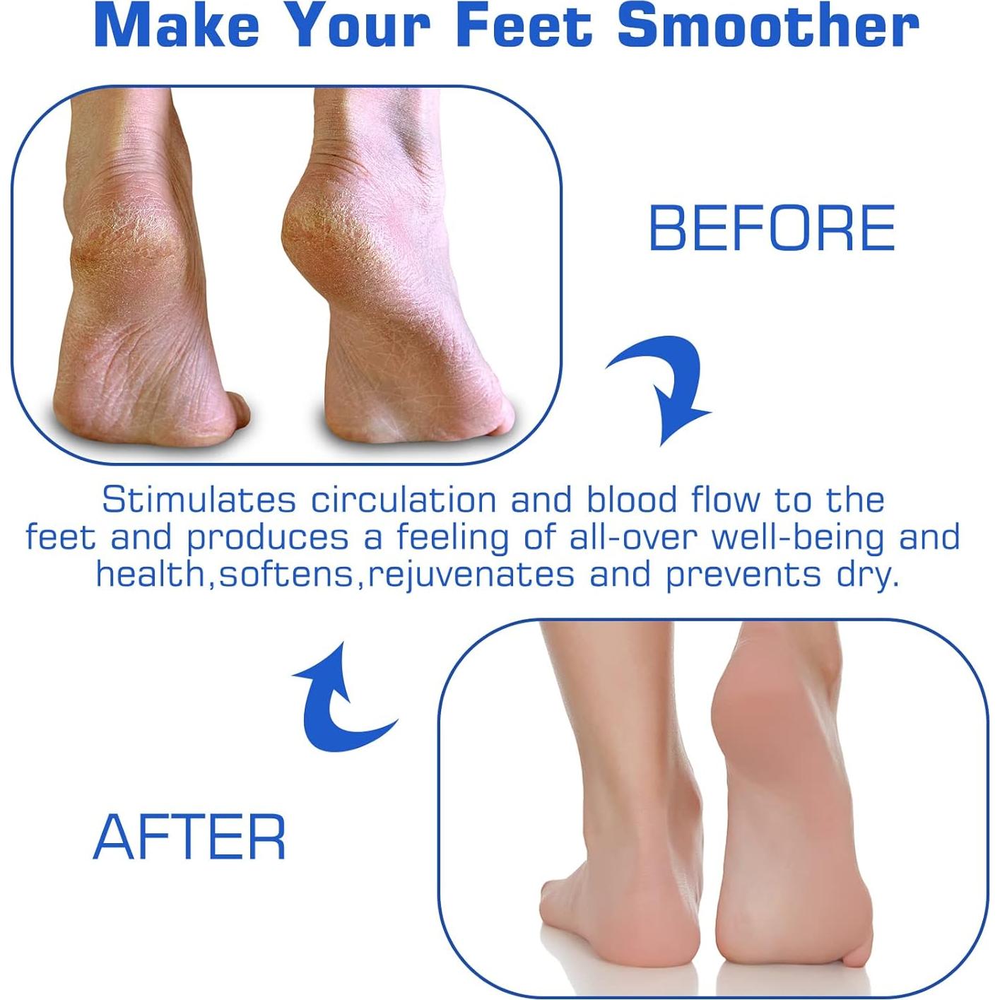 2PACK Alfombrilla Exfoliante para Pies SZZYXD con Ventosas 27.7x20cm