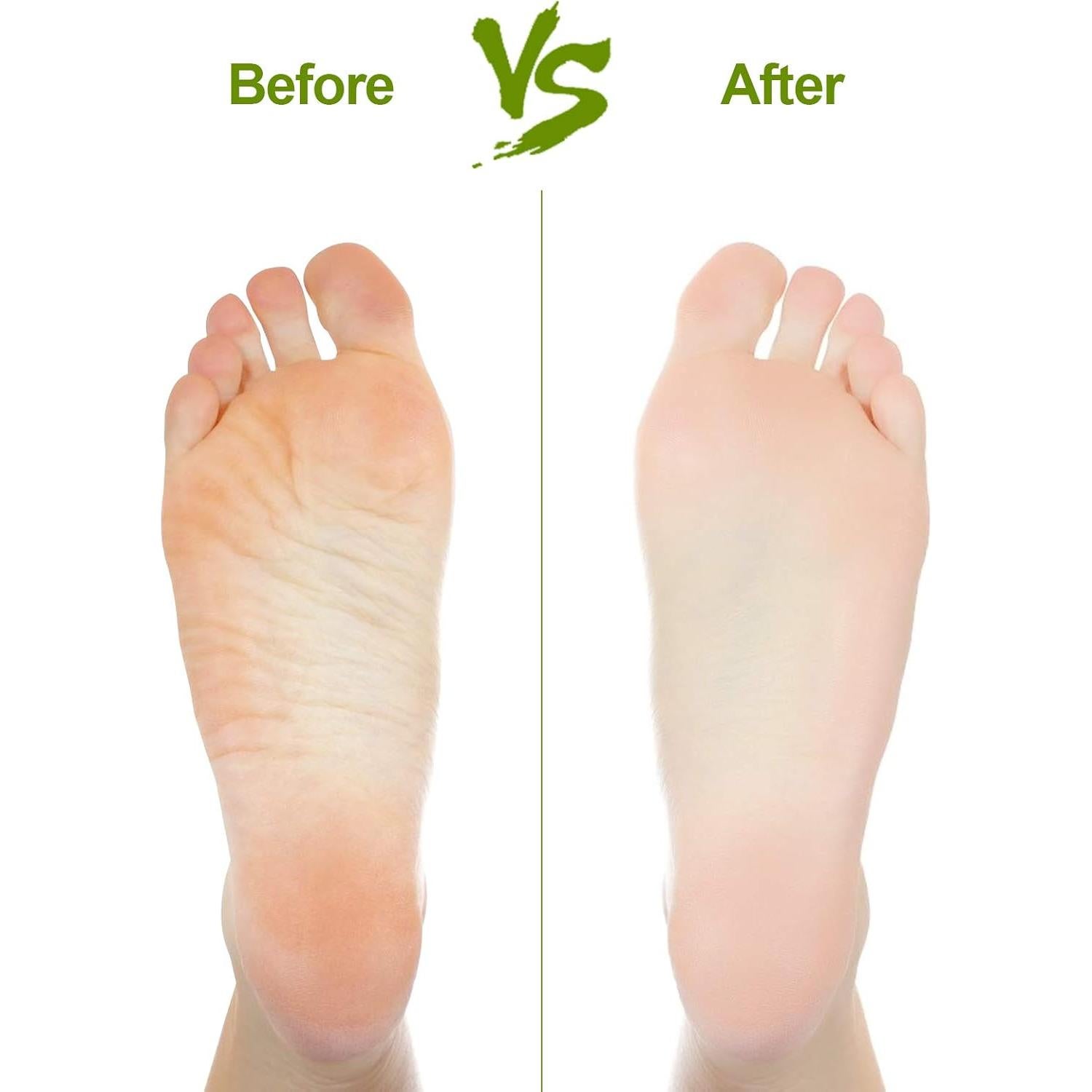 Piedra Pómez Natural Asqraqo 2 Pcs para Remover Callos