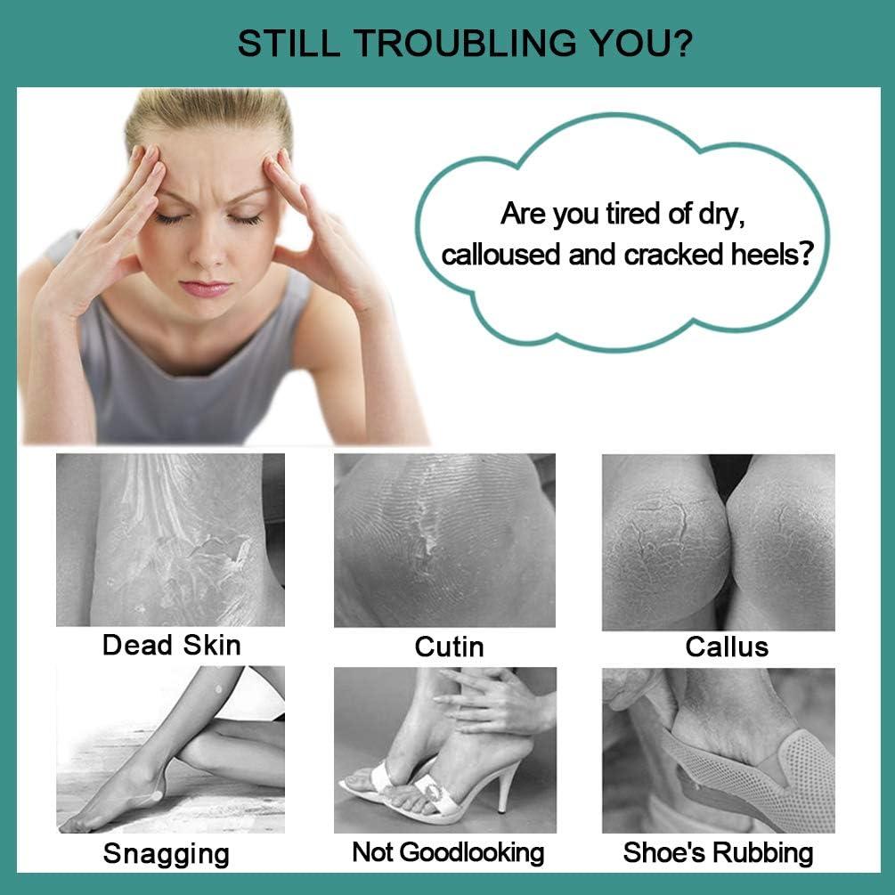 Lima para Pies CAREHOOD 4 en 1 - Pedicura Gris, Exfoliador