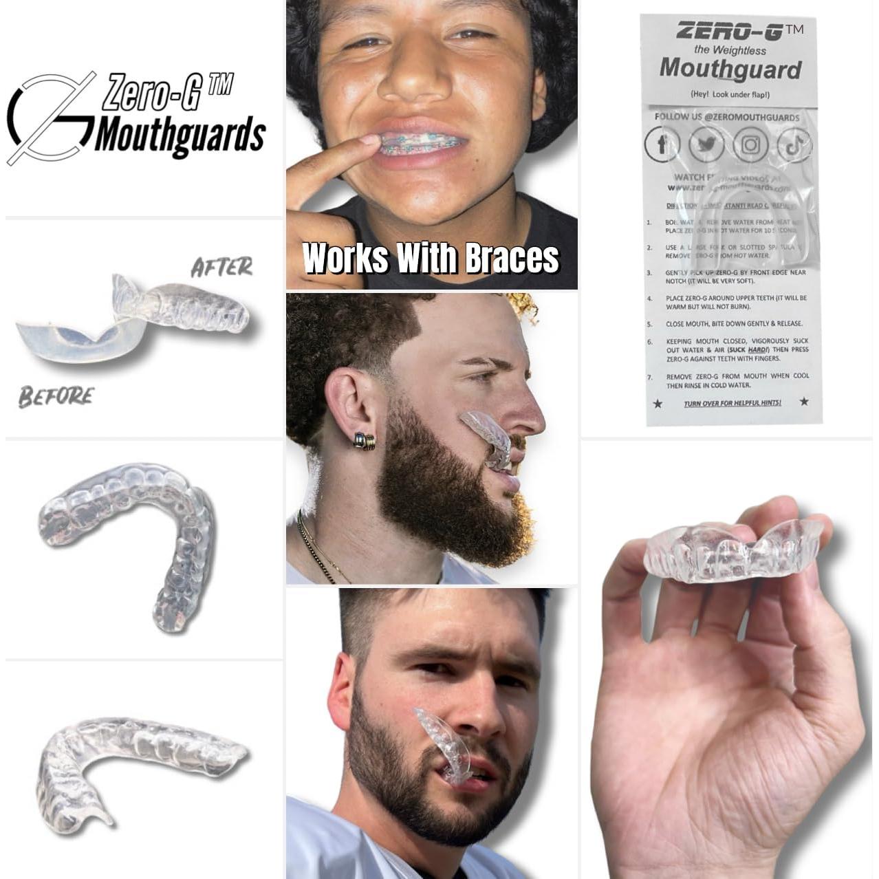 Protector Bucal Zero-G Claro Adulto - Ajuste Personalizado