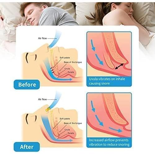 Dispositivo Anti Ronquidos SCTHRL Clip Magnético Nasal Azul