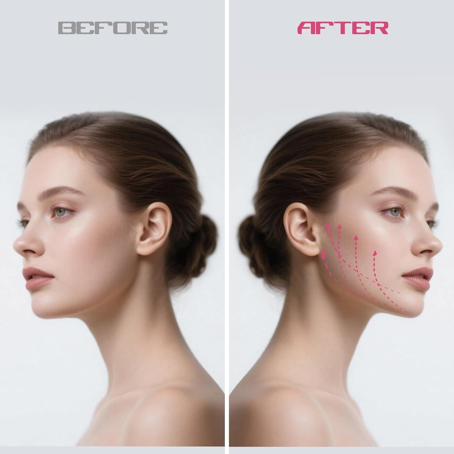 Ejercitador de Mandíbula Azrra AZR-NewJawExerciser 4 Niveles