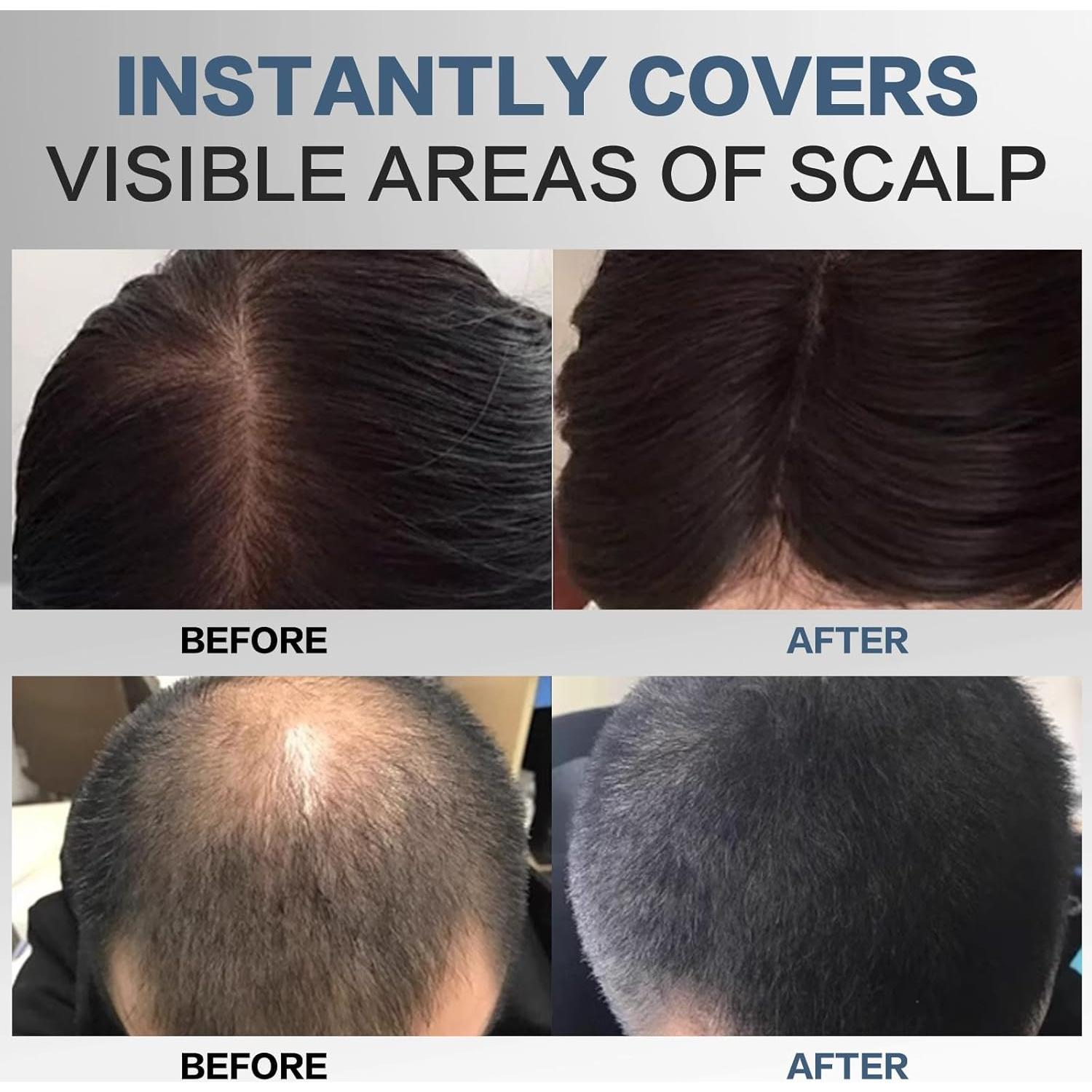 Polvo para Raíces de Cabello Negro IDUCEN 4.14 ml