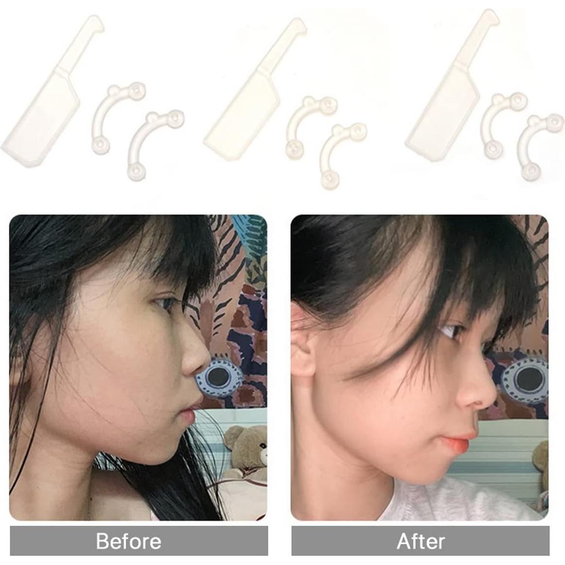 Elevador de Nariz Invisible VANANA - 3 Tamaños de Silicona