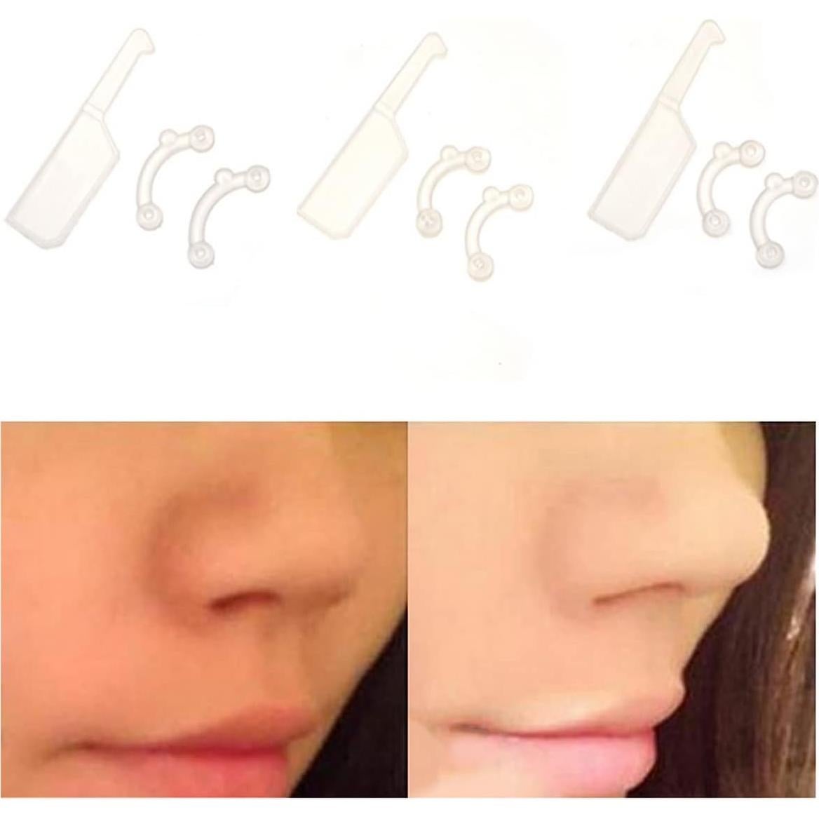 Elevador de Nariz Invisible VANANA - 3 Tamaños de Silicona