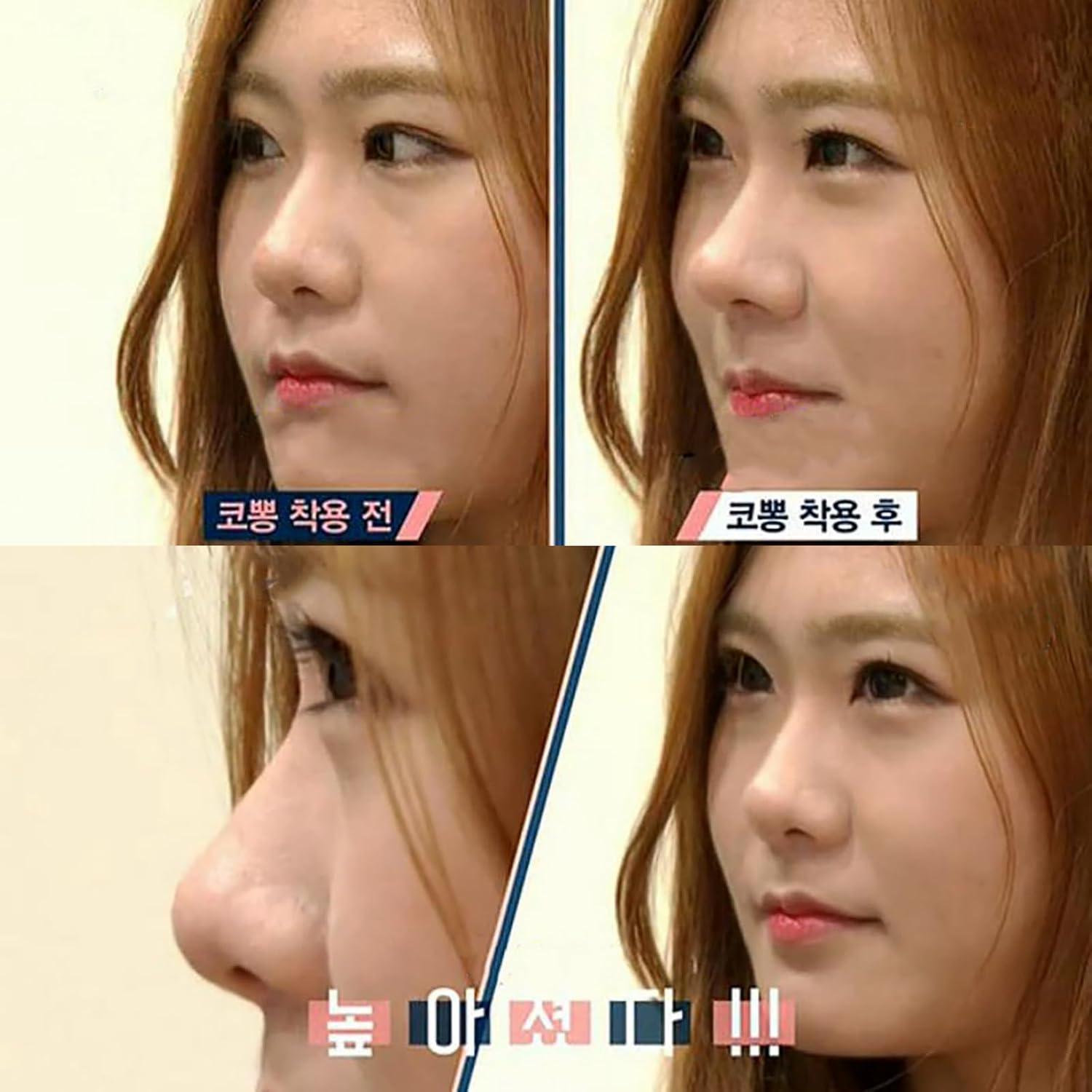 Set de Clips Elevadores de Nariz VANANA - 3 Tamaños Silicona