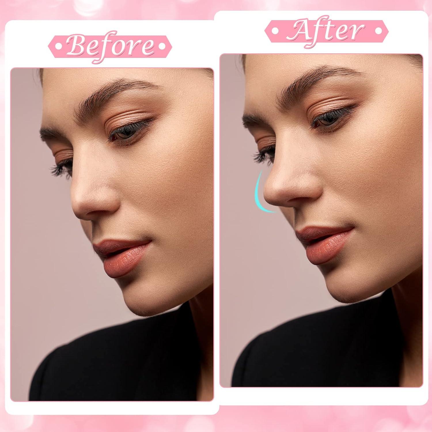 Bonuci 10 Juegos Correctores de Nariz Silicona 3 Tamaños