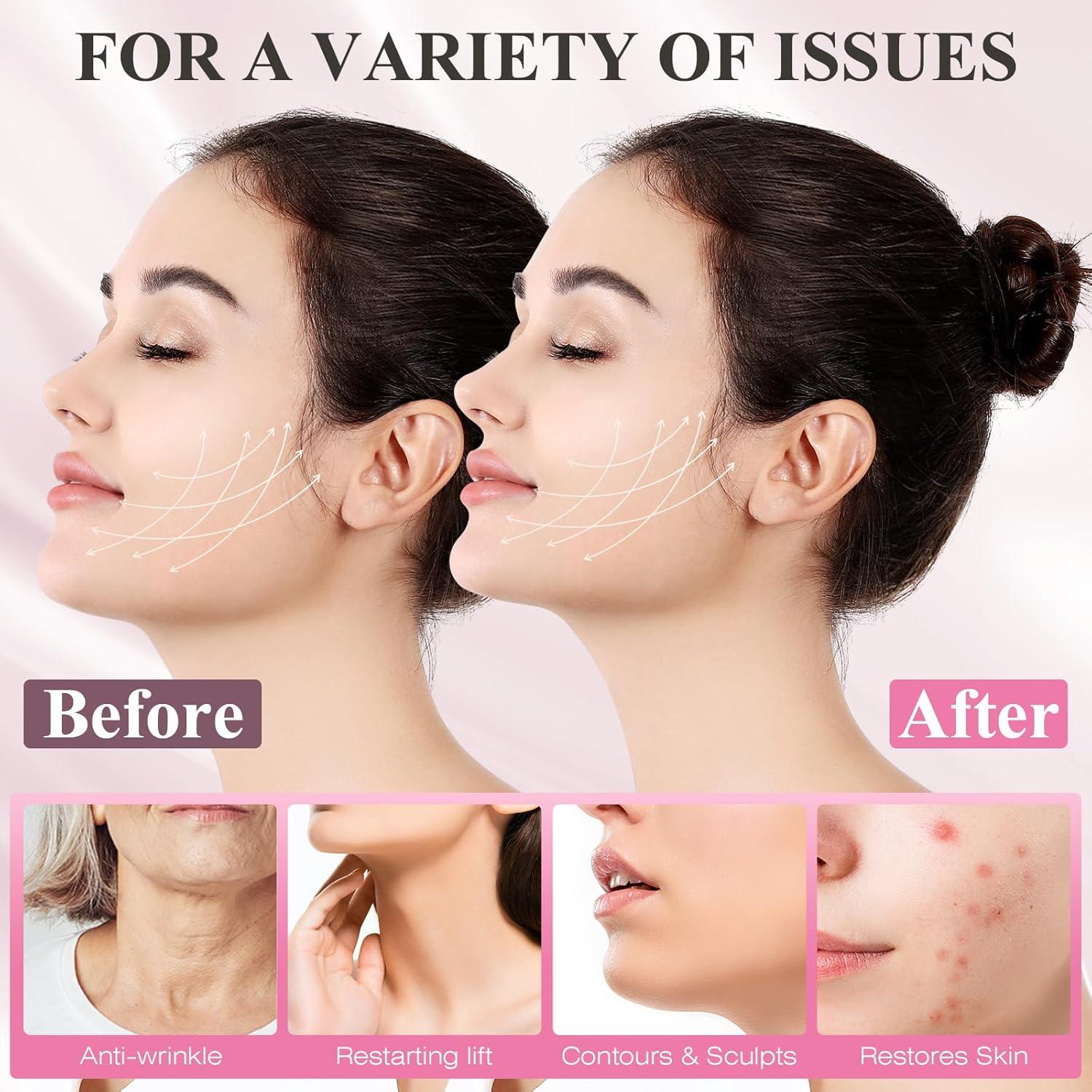 Correa de Barbilla Ajustable Juskaa Rosa M - Modelador Facial