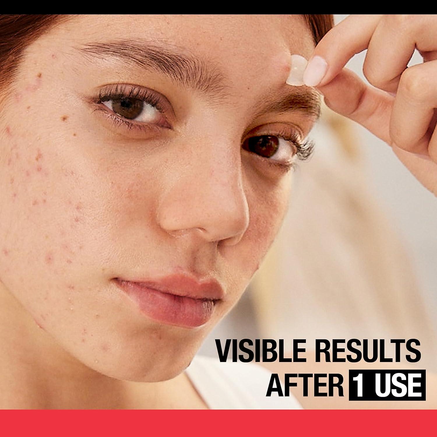 Parche para Granos Neutrogena - 24 Parches Hidrocoloide