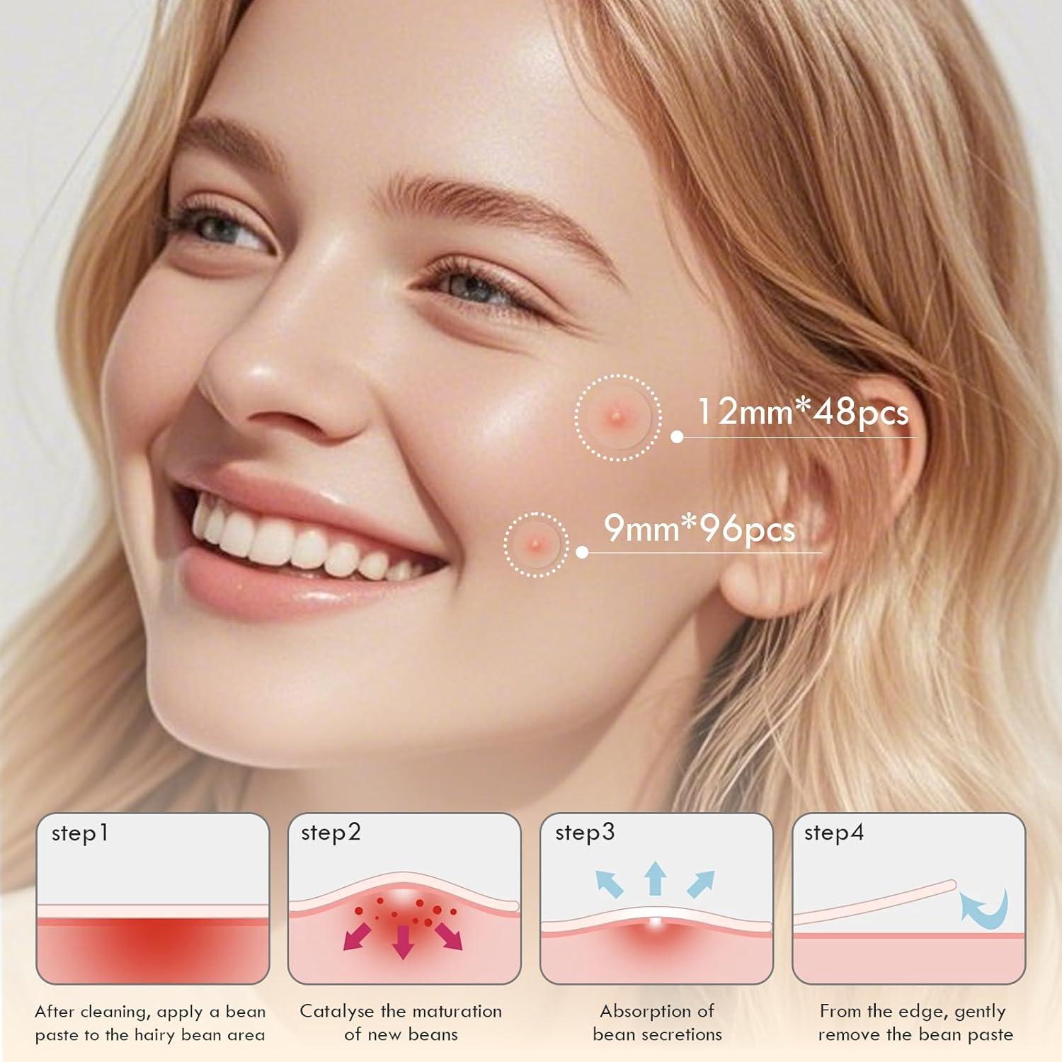 Parches para Granos Blorfo - Hidrocoloides 144 Unidades 9mm/12mm