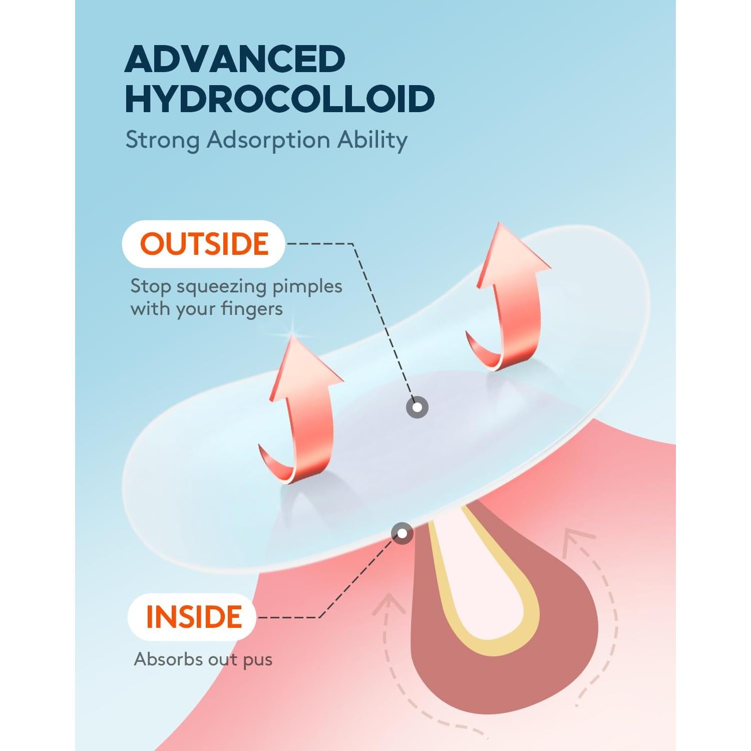 Parche para Granos de Acné ZATKTK - 180 Unidades, 4 Tamaños