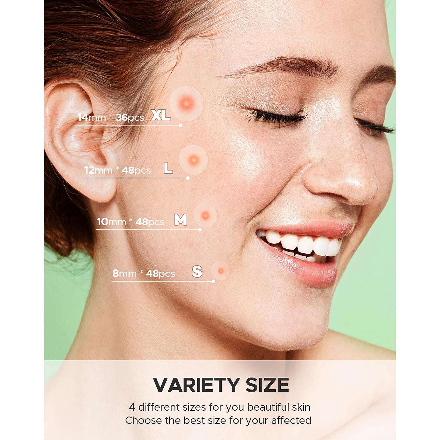 Parche para Granos de Acné ZATKTK - 180 Unidades, 4 Tamaños