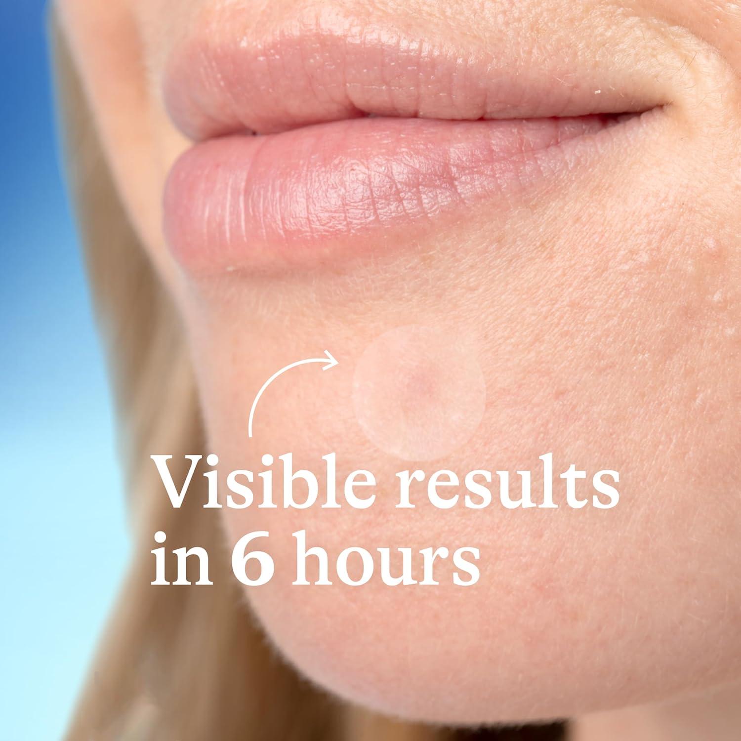 Parche para Acné Differin - 36 Unidades con Ácido Salicílico