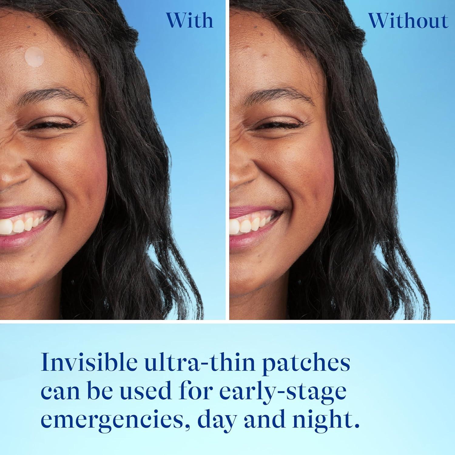 Parche para Acné Differin - 36 Unidades con Ácido Salicílico