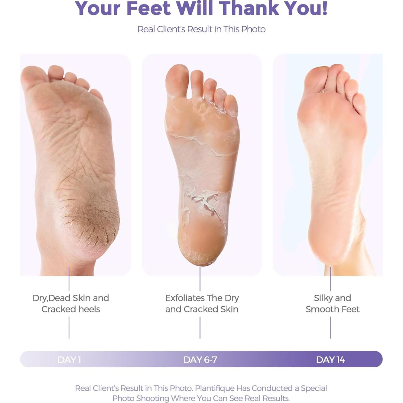 Mascarilla Exfoliante para Pies Rokelos - Lavanda, 1 par