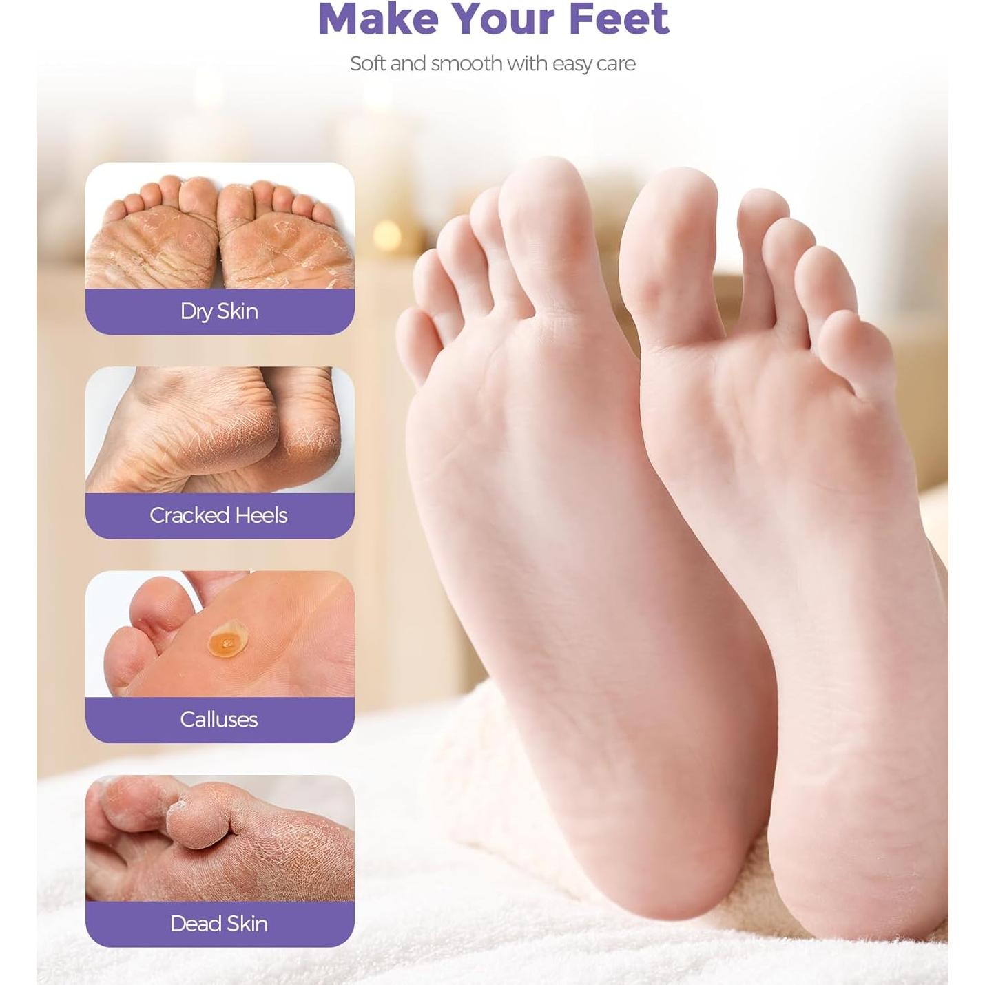 Mascarilla Exfoliante para Pies Rokelos - Lavanda, 1 par