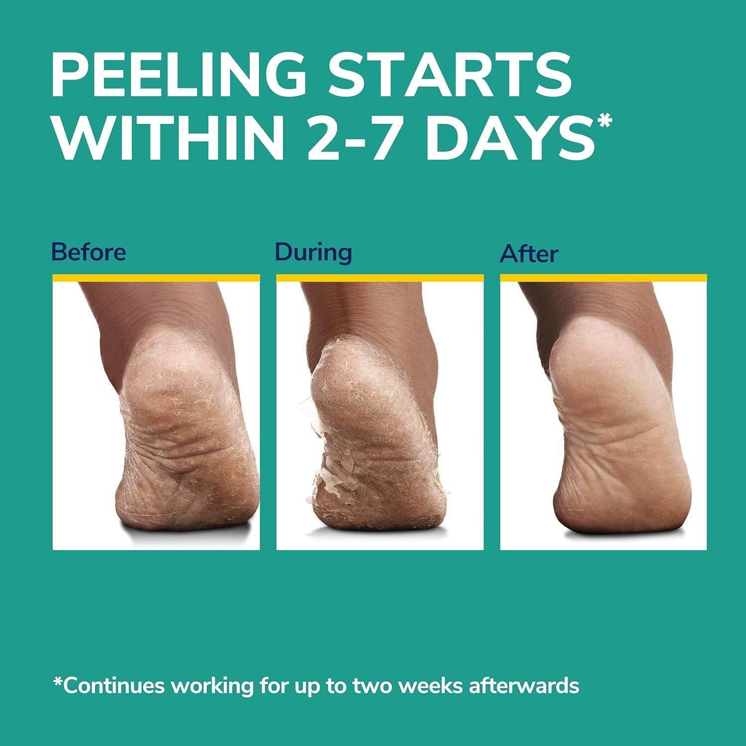 Máscara Exfoliante para Pies Dr. Scholl's - 3 Pares Hidratantes