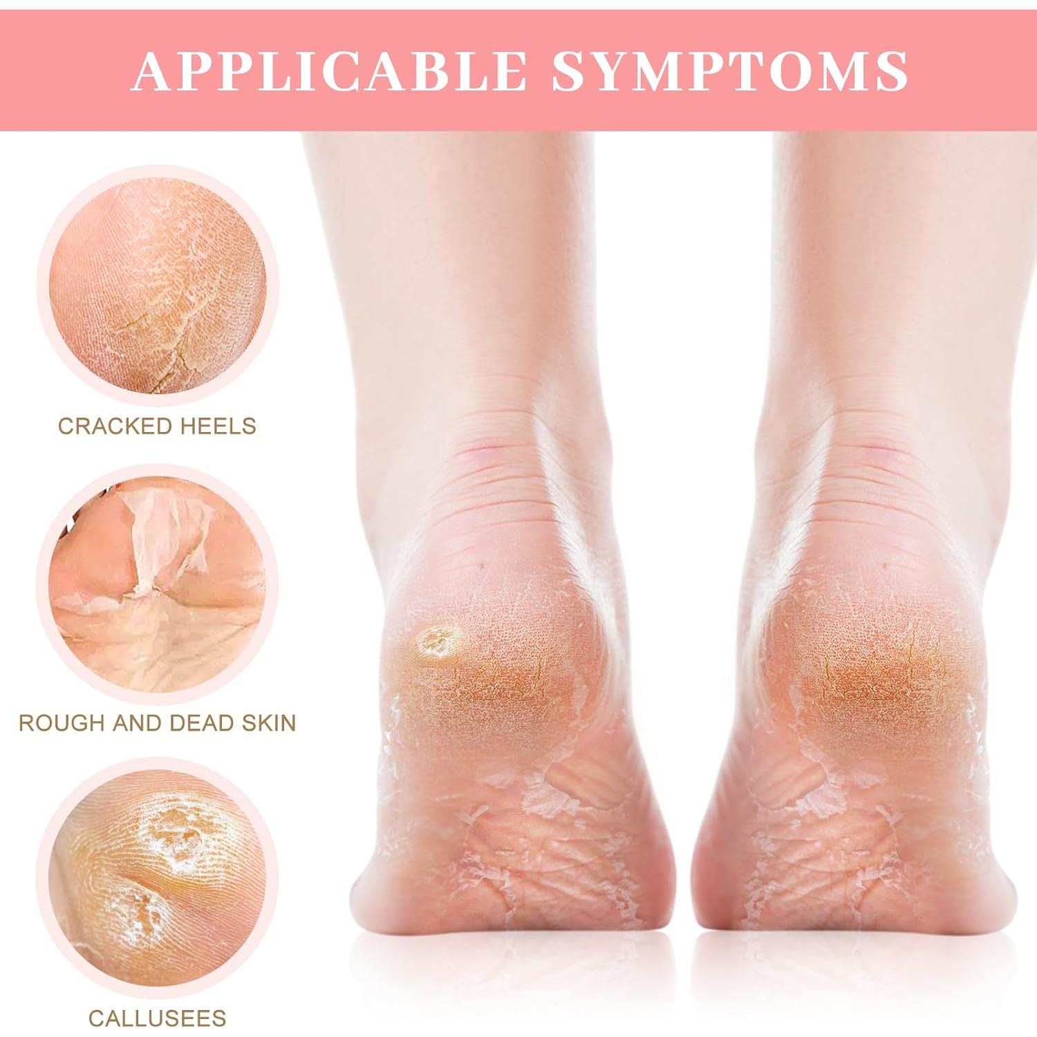 Mascarilla Exfoliante para Pies Berlaney - 3 Pares Durazno