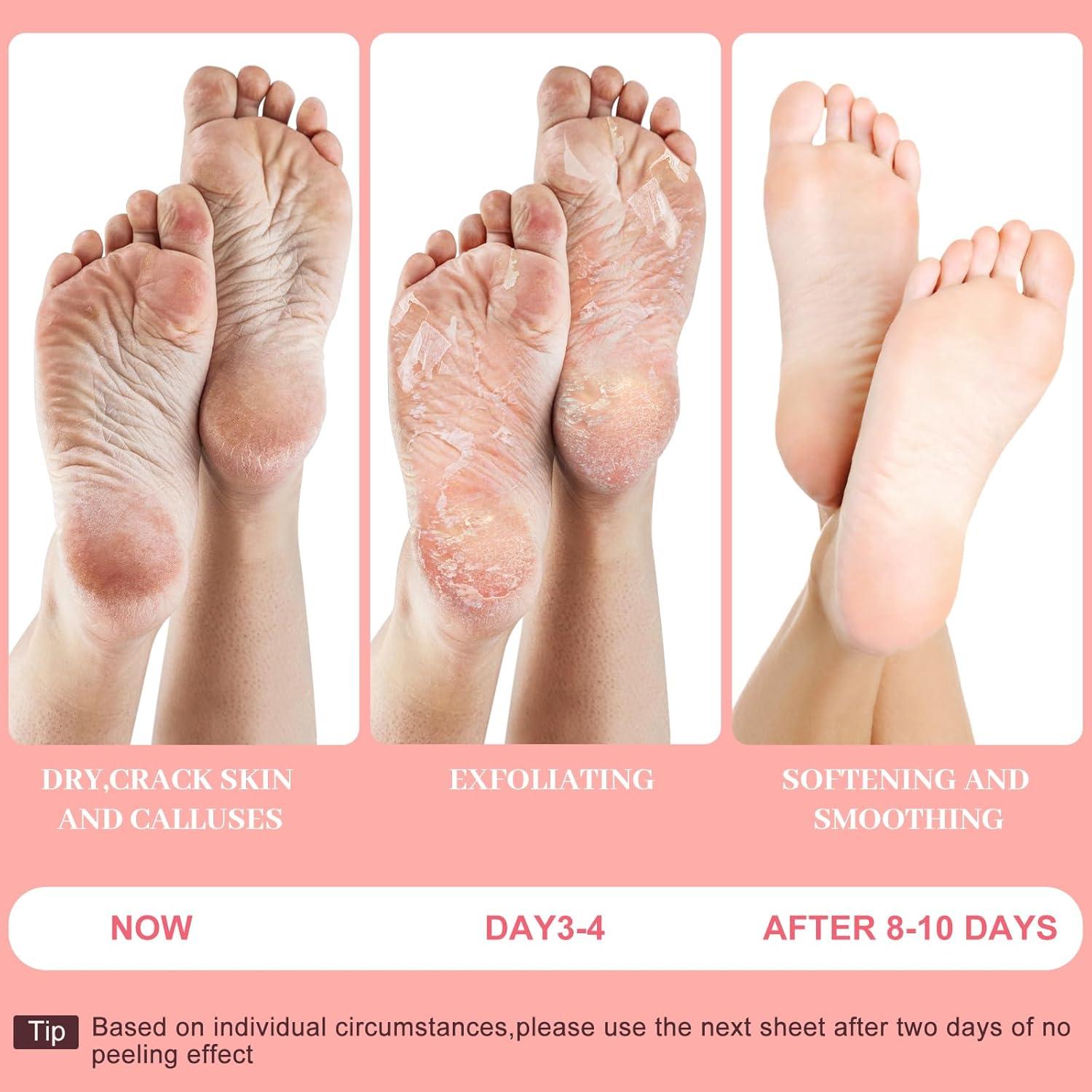 Mascarilla Exfoliante para Pies Berlaney - 3 Pares Durazno