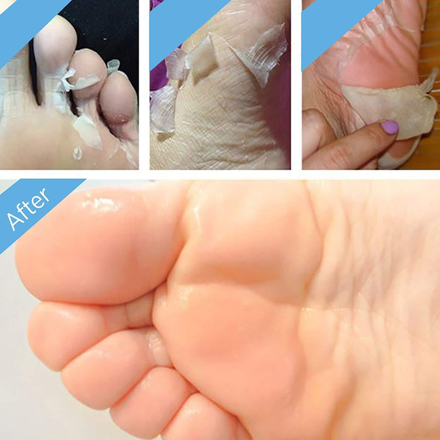 Máscara Exfoliante para Pies BEALUZ - 2 Pares, Suaves en 1-2 Semanas