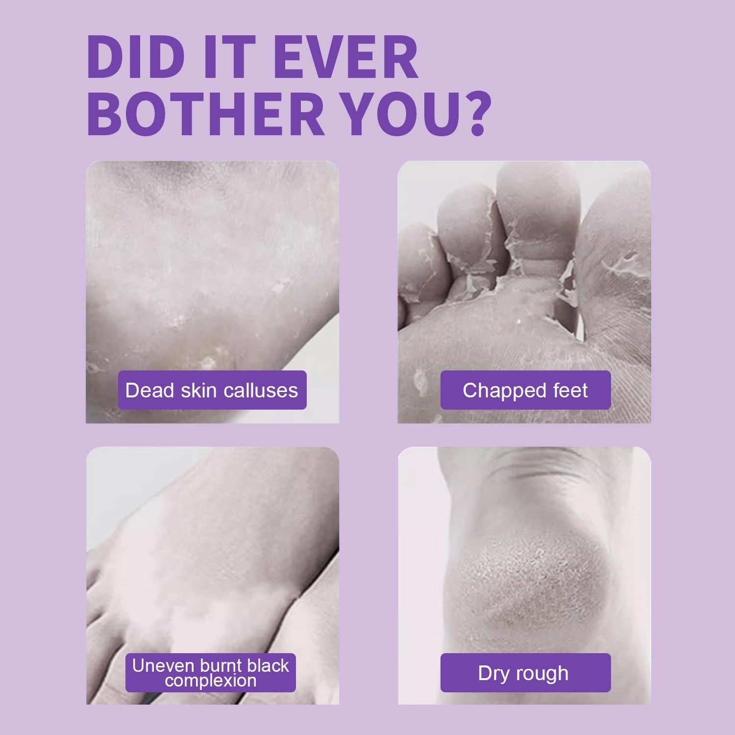 Mascarilla Exfoliante para Pies ILISYA - 5 Calcetines Lavanda