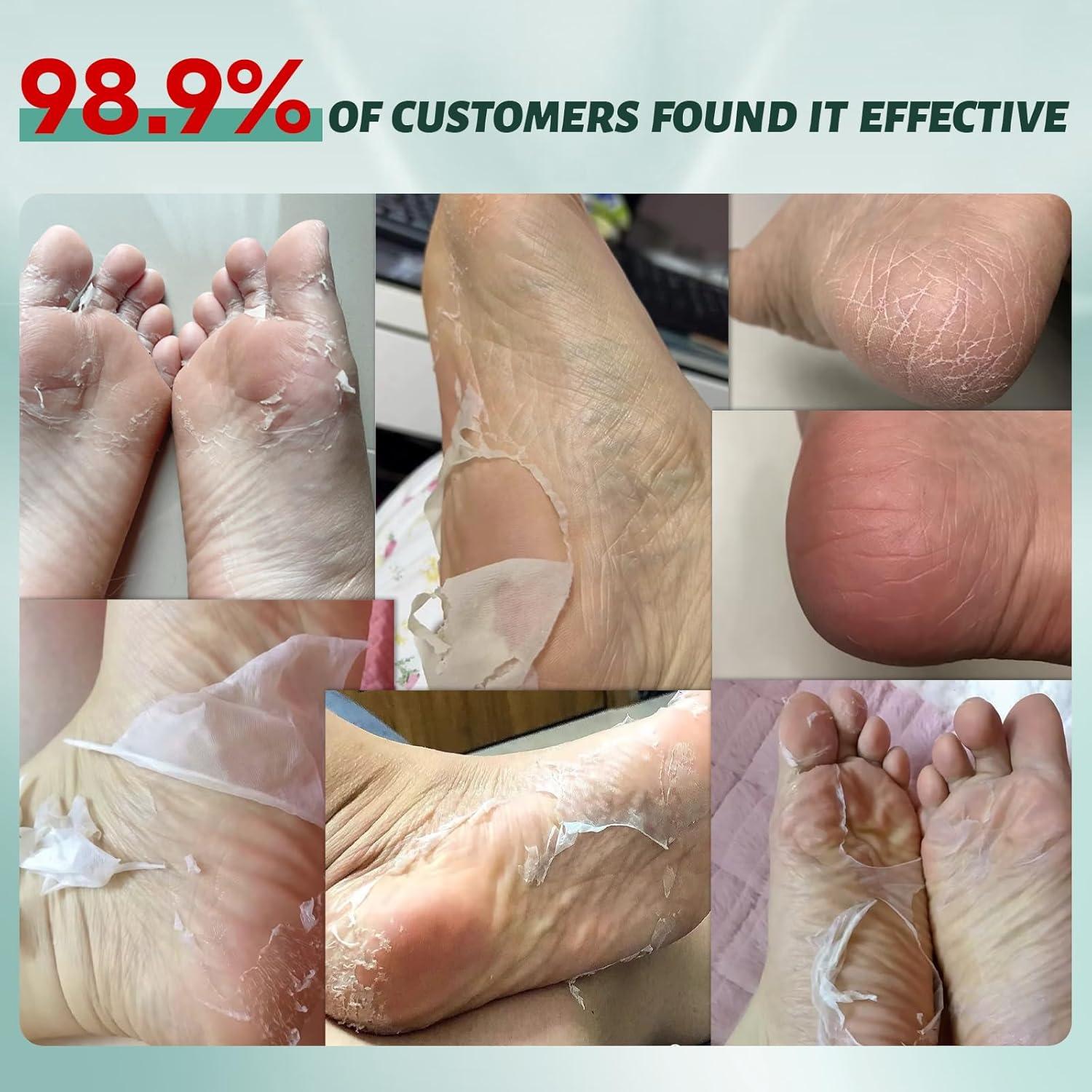 Máscara Exfoliante para Pies VGO - Paquete de 3 Unidades