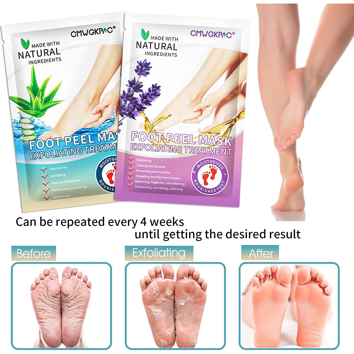 5 Paquete Máscaras Exfoliantes para Pies CMWGKBC - Hidratación