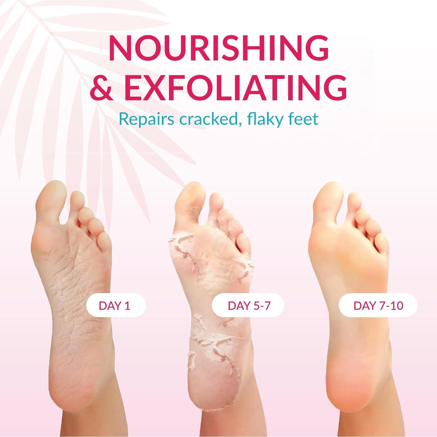 Mascarilla Exfoliante para Pies Summer Foot - 2 Pares con Urea