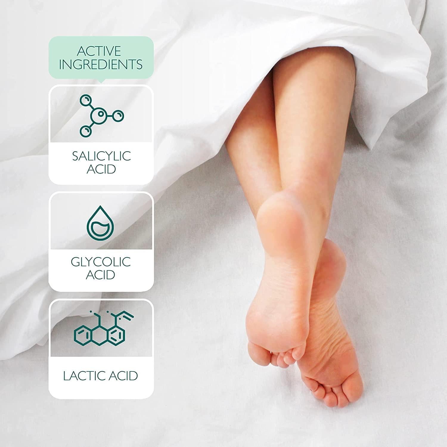 Mascarilla Exfoliante para Pies Patchology PoshPeel 1 Par